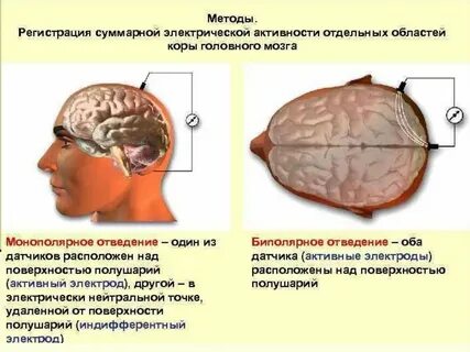 Метод регистрации биоэлектрической активности мозга