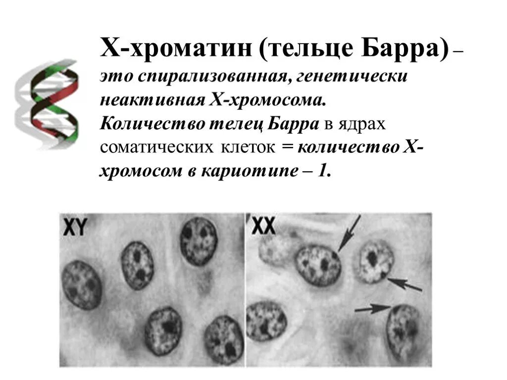 Синдром тельца. Тельце Барра в клетках буккального эпителия. Половой хроматин тельца Барра. Синдром Дауна тельце Барра. Таблица половой хроматин тельце Барра.