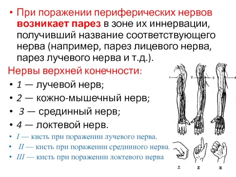 Сенсорное поражение нижних конечностей. Иннервация срединного, лучевого нерва. Проекционная линия срединного нерва. Повреждение лучевого нерва верхней конечности. Симптомы и синдромы поражения срединного нерва.