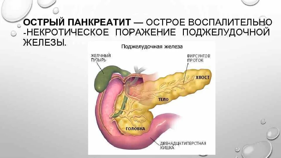 Острый панкреатит поджелудочной железы. Болезни пищеварительной системы человека панкреатит. Деструктивный панкреатит поджелудочной железы. Острый панкреатит хронический панкреатит. Вода и поджелудочная железа