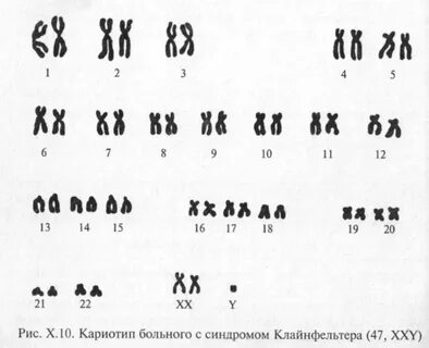 Отсутствие пары хромосом