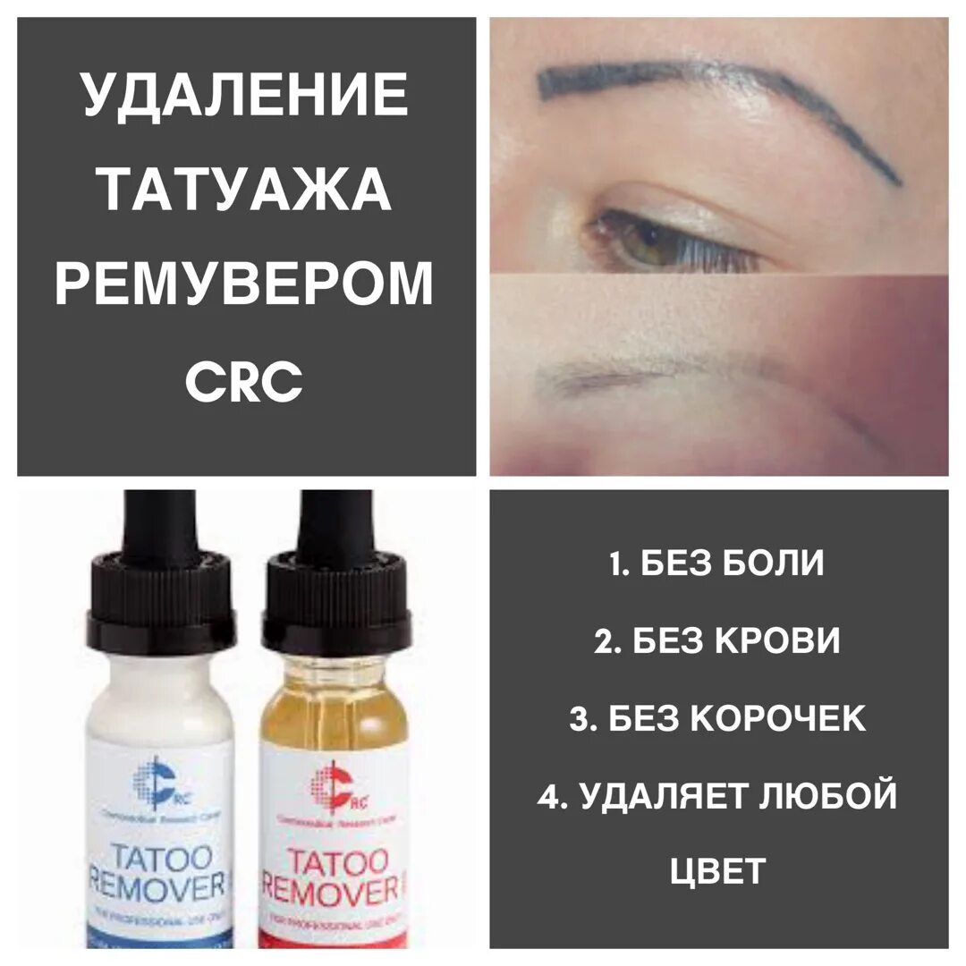 Ремувер Anacod Tattoo Remover - 5 ml - купить по выгодной цене в Bazar78.ru