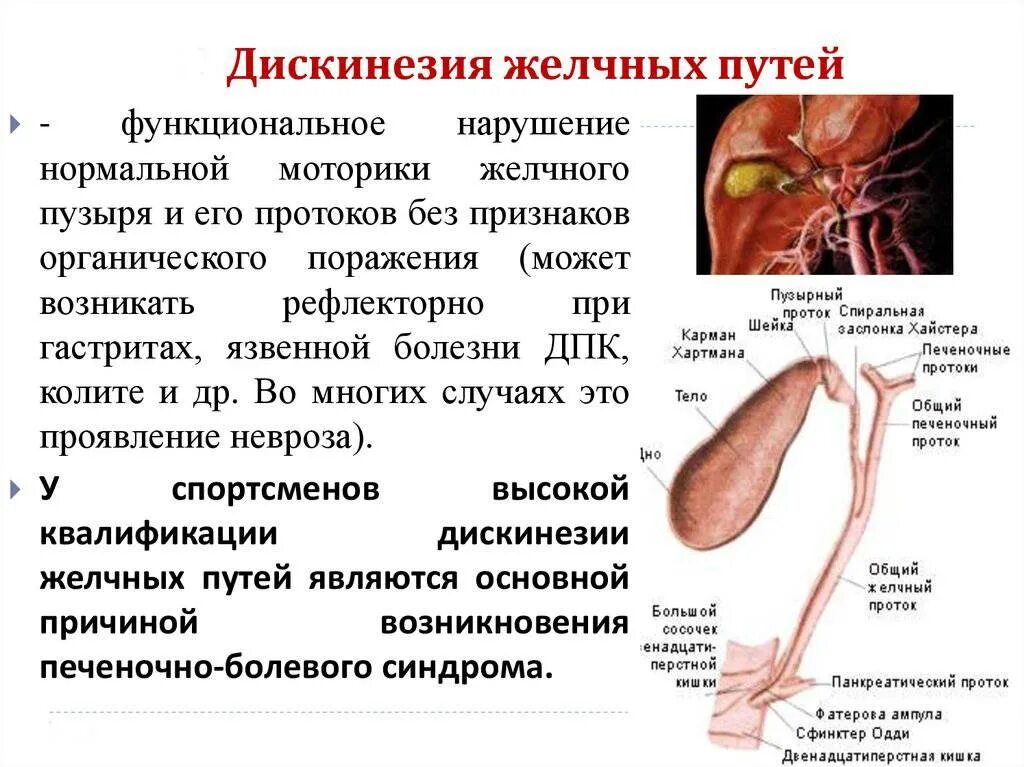 Дискинезия желчного пузыря симптомы. Дискинезия желчных путей симптомы. Дискинезия желчного пузыря терапия. Дискинезия желчевыводящих путей симптомы на коже.