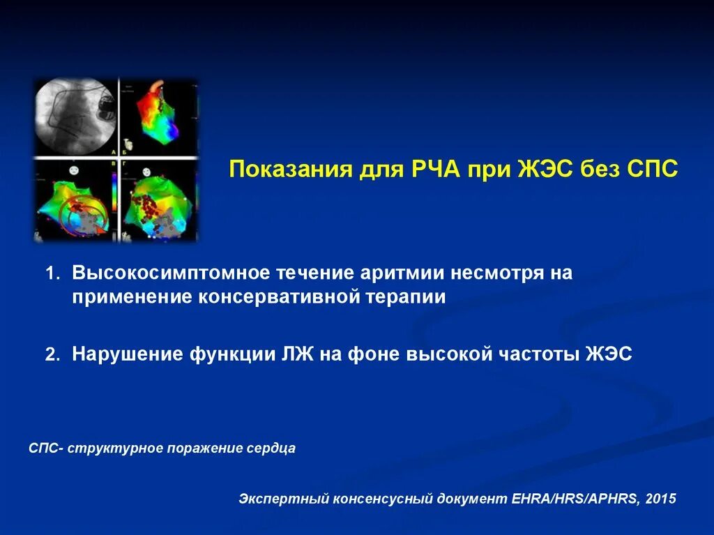 Сколько лежать после рча. Радиочастотная катетерная абляция фибрилляции предсердий. после рча сердца восстановительный период. показания к радиочастотной абляции. показания к рча.