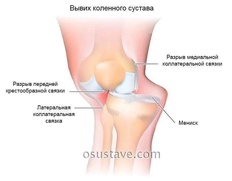 Гудят колени причины. Коленный сустав. Чашечка коленного сустава. Боль под коленной чашечкой. Сустав колена.