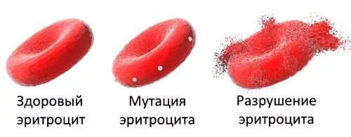 Гемолиз разрушение эритроцитов. Разрушенные эритроциты. деструкция эритроцитов. эритроцит лопается.