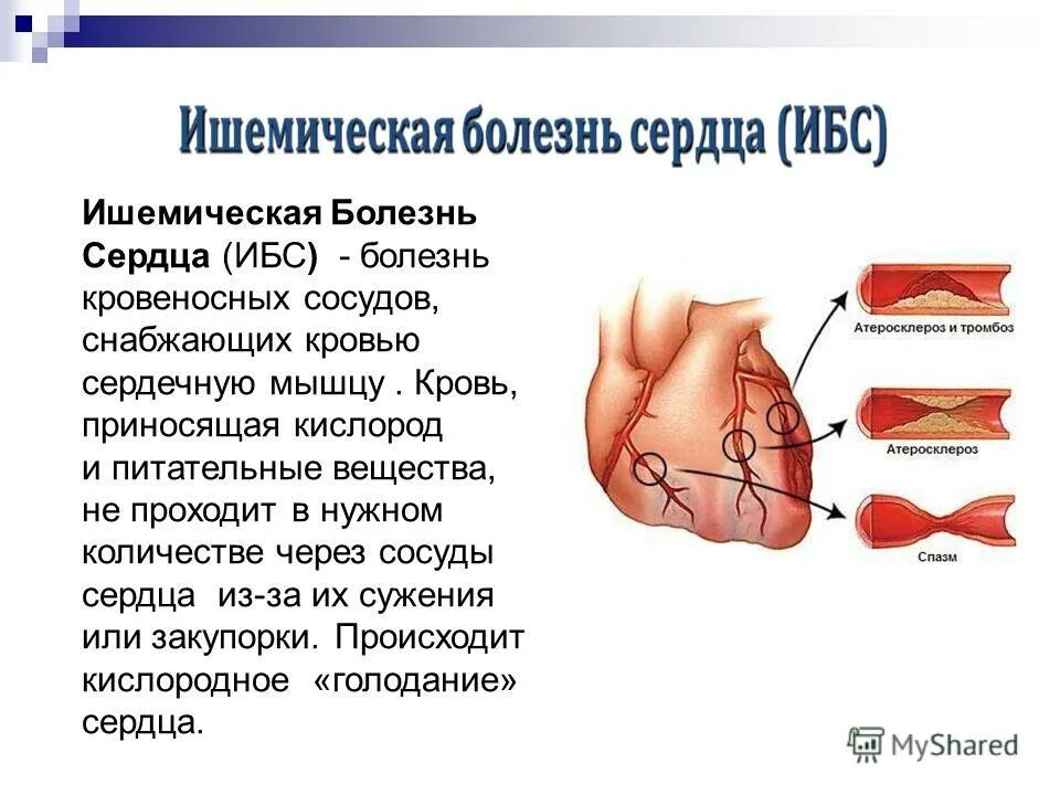 Чем опасна ишемия