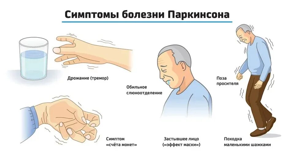 Синдром тряски. Болезнь Паркинсона симптомы. Клинические синдромы при болезни Паркинсона. Паркинсонизм и болезнь Паркинсона симптомы. Симптомы Паркинсона тремор.