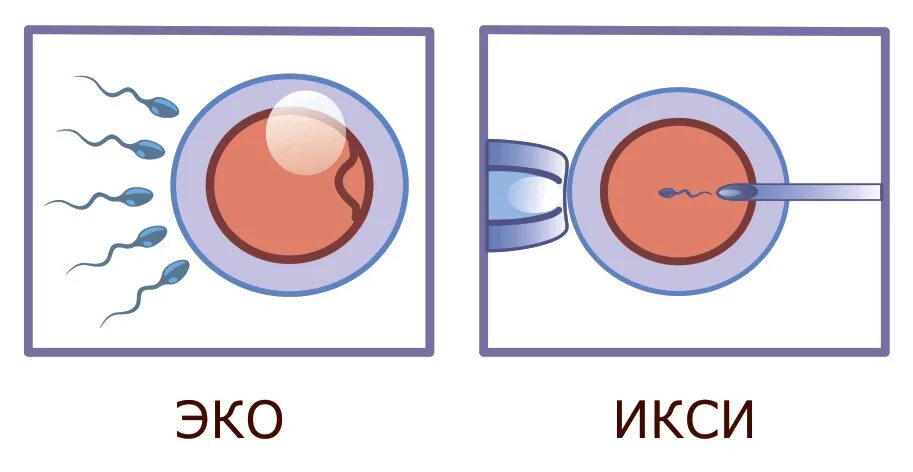 Отличие эко от эко. Оплодотворение методом икси что это. эко икси. эко оплодотворение икси. эко+икси этапы.