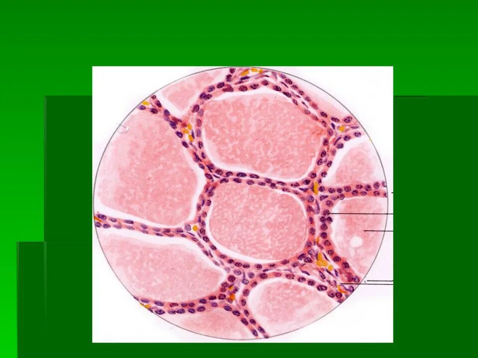 Фолликул щитовидной железы что это. Тироциты щитовидной железы. Тироциты щитовидной железы гистология. Фолликулярные тироциты. Тироциты строение.