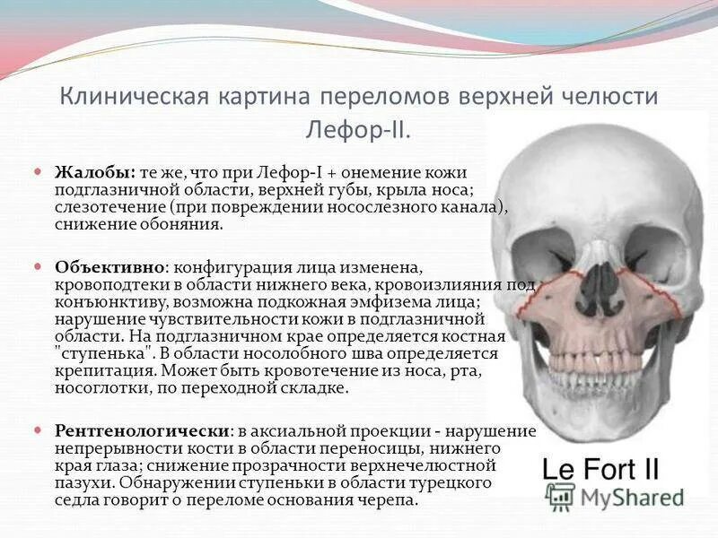 Картинки Г В В ЧЕЛЮСТНО ЛИЦЕВОЙ
