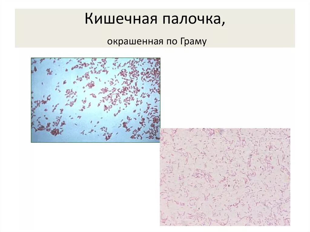 Кишечная палочка по граму. Энтеробактер микробиология. Эшерихия коли микробиология. Представители энтеробактерий окрашиваются по грамму. Энтеробактерии окрашиваются по граму.