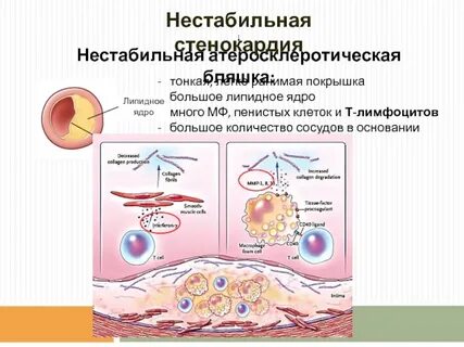 Пенистые макрофаги