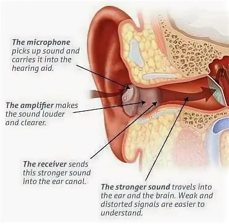 Hearing перевод. Deaf vs hearing. deaf and hard of hearing children. deaf and hard of hearing entrepreneurs council.. the scheme of hearing aids.