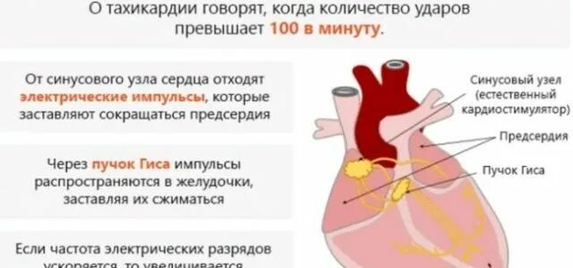 Что делать при тахикардии в домашних условиях. Учащенное сердцебиение. Тахикардия физиология. Физиологическая тахикардия. Тахикардия сердца.