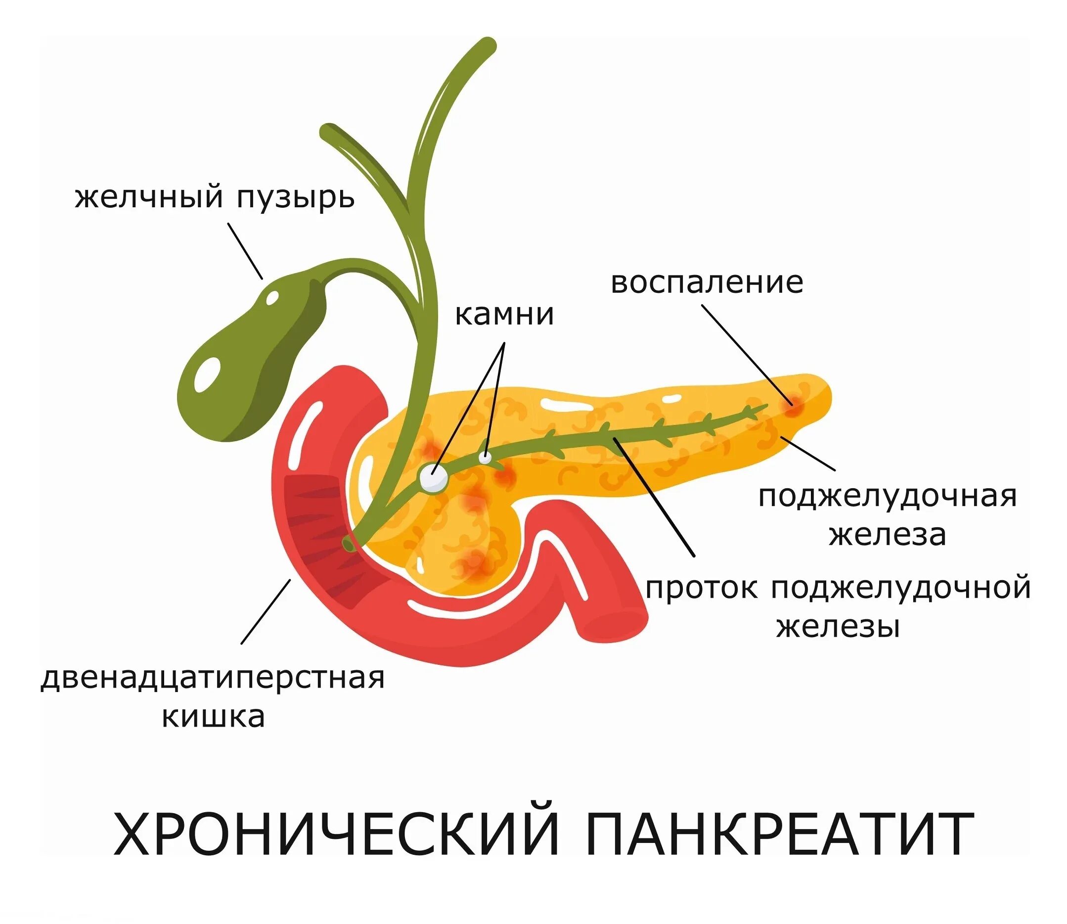 Болит поджелудочная что делать