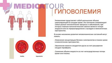 После анализа стало плохо