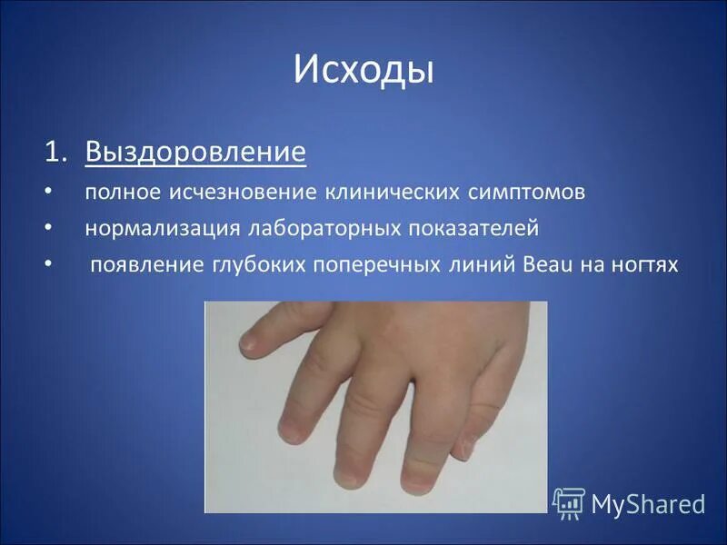 Синдром кавасаки у детей сыпь. Кавасаки болезнь диагностические критерии у детей. Кавасаки вирус. Кавасаки синдром критерии диагностические. Кавасаки вирус.