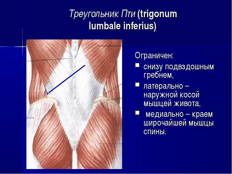 Какое анатомическое образование является дном trigonum lumbale. Какое анатомическое образование является дном trigonum lumbale