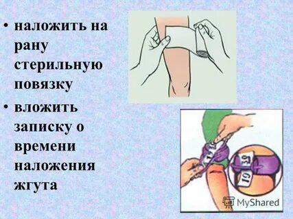 Продолжительность наложения жгута