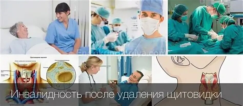 Инвалидность при удалении щитовидной