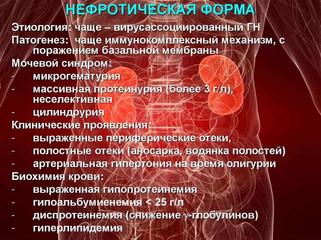 Нефротический синдром чаще встречается при малярии. Нефротическая протеинурия. Иммунокомплексный гломерулонефрит. Протеинурия при нефритическом синдроме. Нефротический синдром этиология патогенез.