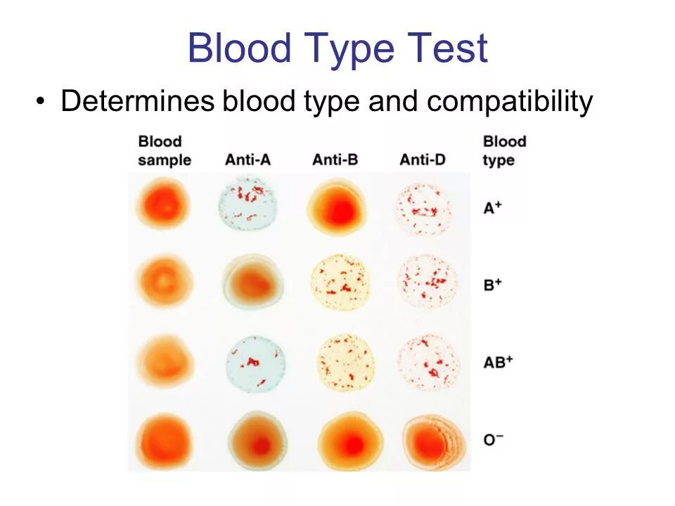 Тест на определение группы крови. Экспресс тест на определение группы крови. Blood Type Compatibility.