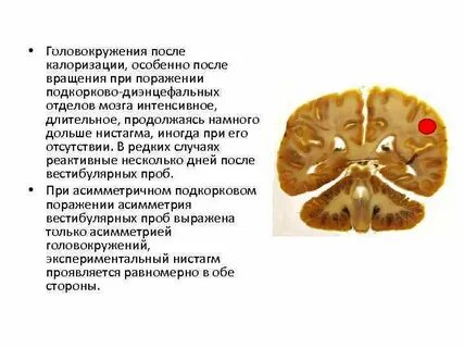 Дисфункция стволового мозга