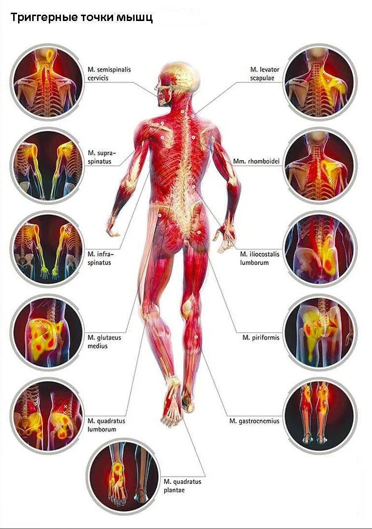 Атлас триггерных точек на теле человека. Суставные боли. Почему болят суставы и мышцы всего тела. Почему болят суставы и мышцы всего тела. Почему болят суставы и мышцы всего тела.