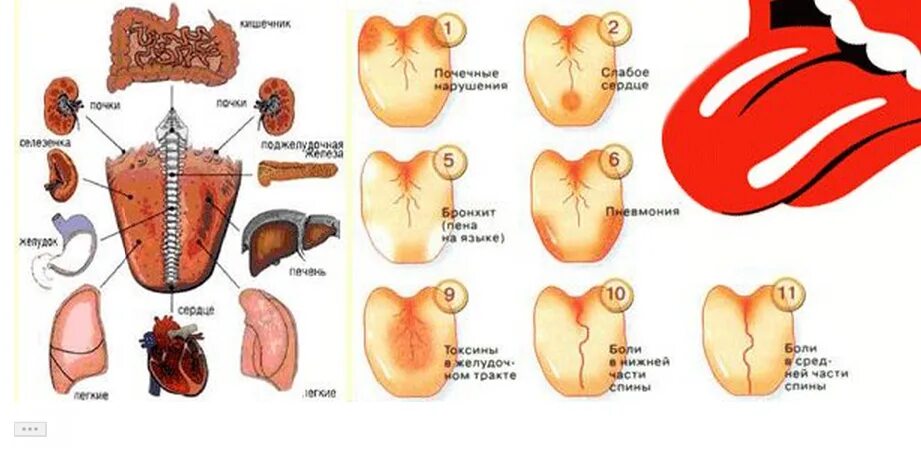 Как отличить заболевания. Болезни по языку определить. Заболевание по цвету языка у человека.