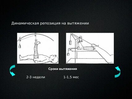 Репозиция это