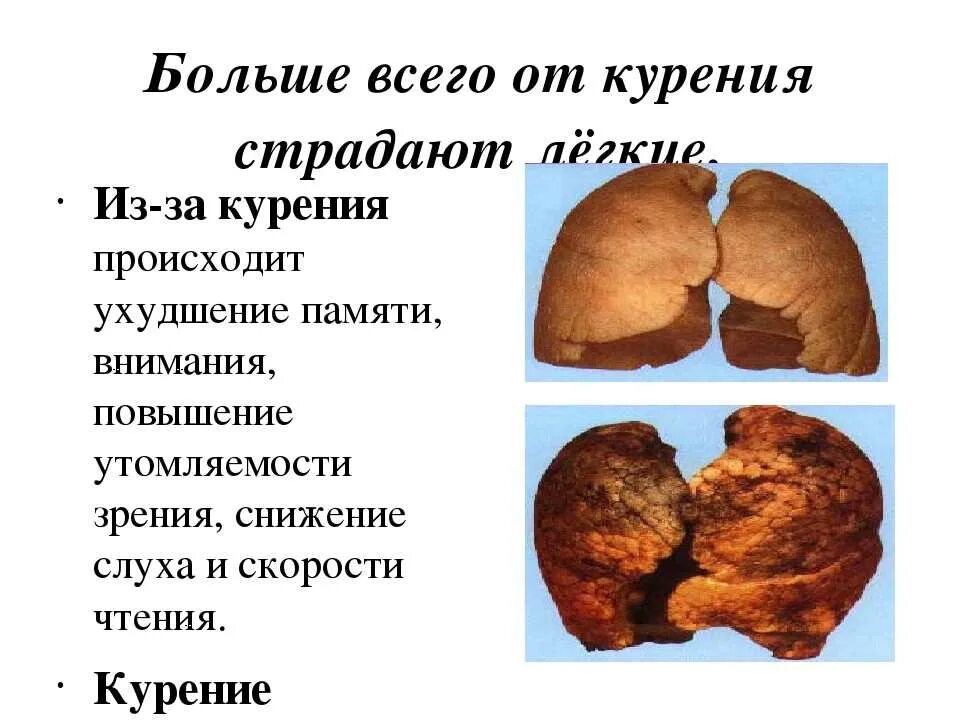 Вред картинки. Курение классный час. Презентация на тему курение или жизнь. ЗОЖ курение. ЗОЖ вред курения.