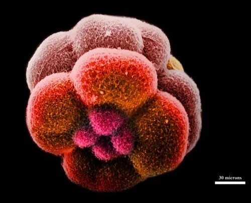 Эмбриональная стволовая клетка. Эмбриональные стволовые клетки под микроскопом. Фотография эмбриональной стволовой клетки.
