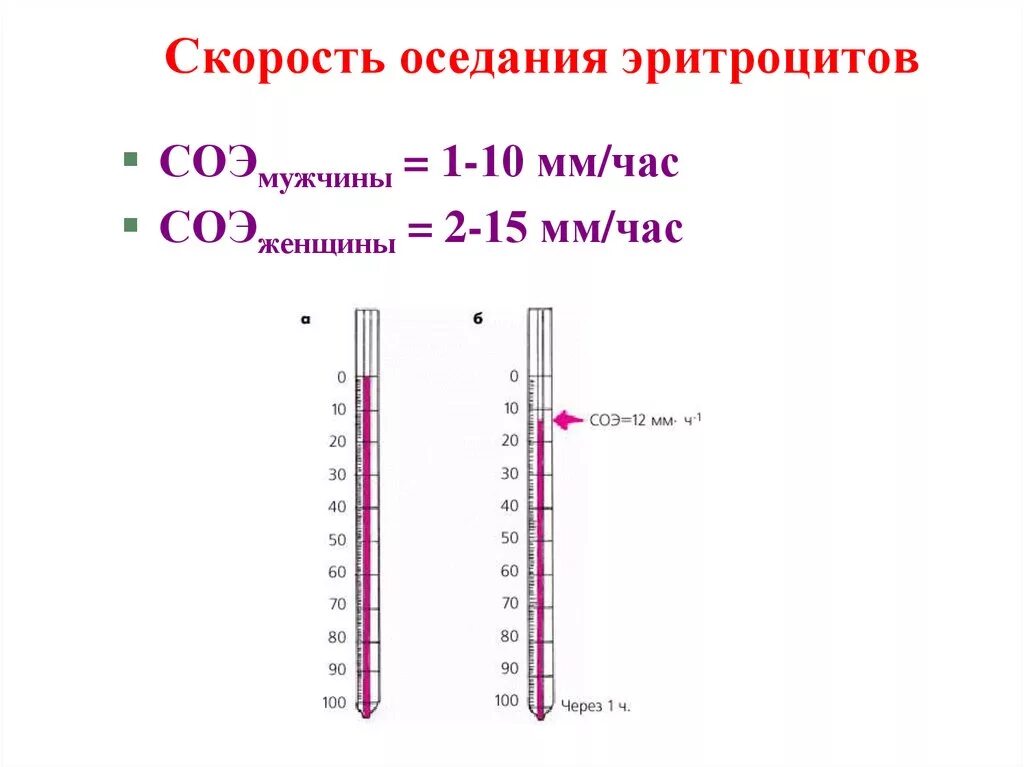 Скорость оседания эритроцитов метод. Скорость оседания эритроцитов (соэ). метод панченкова соэ. скорость оседания эритроцитов по панченкову норма. методика определения соэ по панченкову.