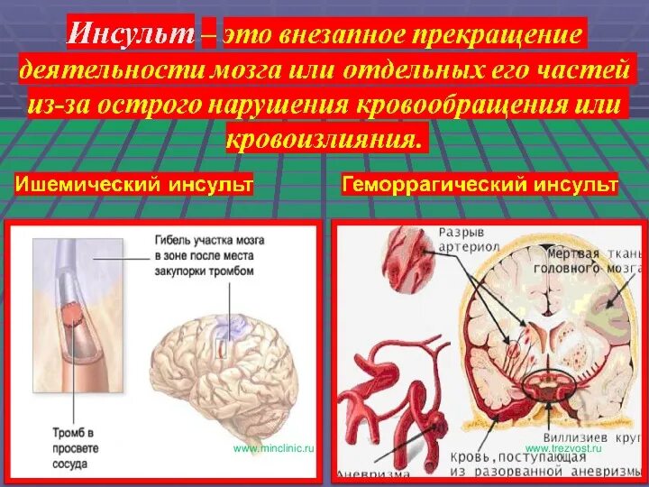 Острая сердечная недостаточность инсульт ОБЖ. Первая помощь при острой сердечной недостаточности и инсульте. Презентация на тему инсульт. Первая помощь при острой сердечной недостаточности и инсульте ОБЖ. Обж острая сердечная недостаточность