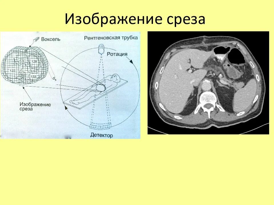 Какие виды кт