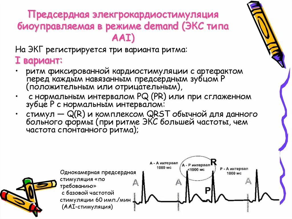 Экс примеры