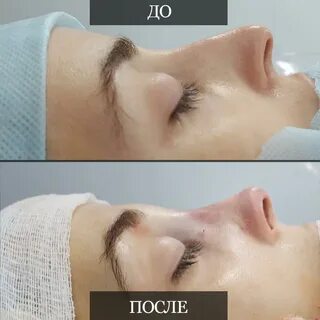 Абрамян пластический