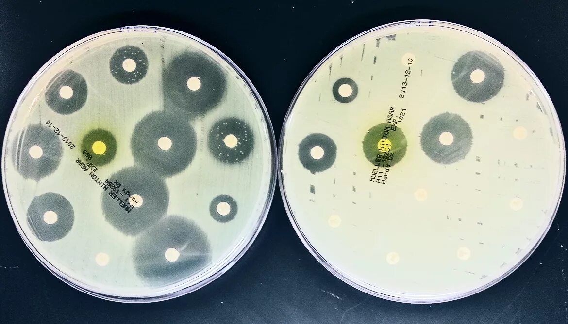 Пенициллин устойчивый. S. aureus золотистый стафилококк. Стафилококк ауреус в чашке Петри. Чашка Петри чувствительность к антибиотикам. Чашка Петри с бактериями стафилококки.