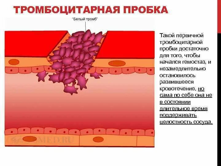 Образование антител разрушение эритроцитов образование тромба. Тромбоцитарная пробка первичный гемостаз. механизм образования тромбоцитарной пробки. образование тромбоцитарного тромба.