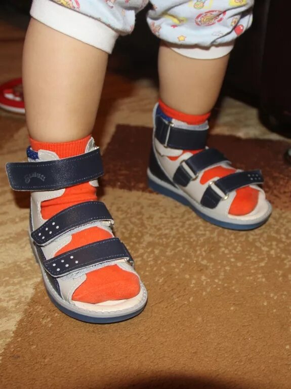 Ортопедическая обувь для вальгусной стопы. Ортопедическая обувь для детей при вальгусной деформации. Детская ортопедическая обувь на ноге. Обувь ортопедическая детская для вальгусной стопы. Ортопедические ботиночки для малышей.