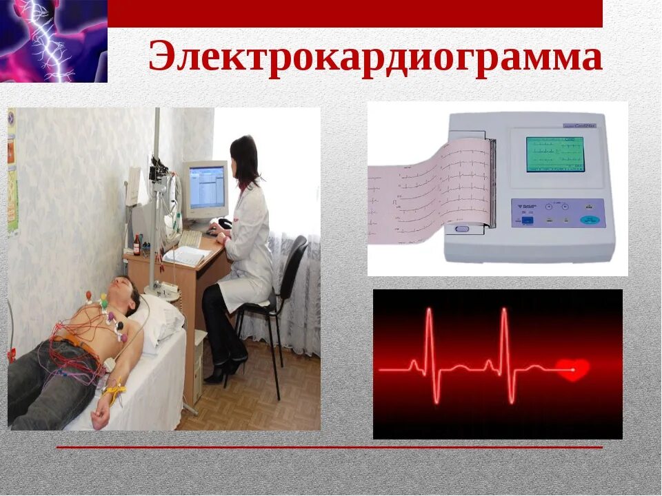 Electrocardiography (ЭКГ). Электрокардиография метод исследования. Проведение ЭКГ исследования. Методы диагностики ЭКГ. Экг сочи