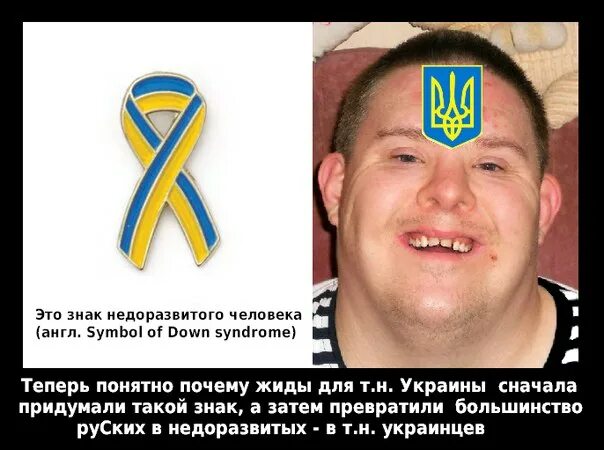 Национальность хохол. Украинцы лохи. Украинцы хохлы. Тупые украинцы. Украинцы глупая нация.