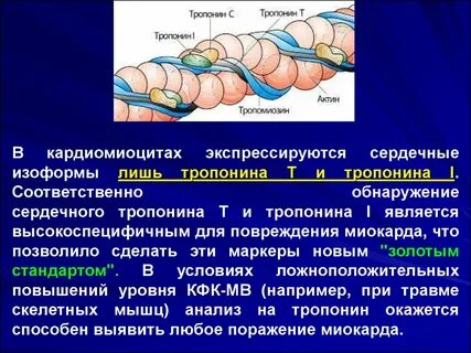 Тропонин