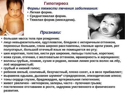 Заболевание с рождения