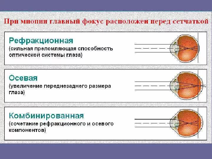 Аккомодация таблица. Состояния покоя аккомодации таблица. Состояния аккомодации глаза таблица. Аккомодация глаза состояние покоя. Аккомодация глаза состояние покоя аккомодации.