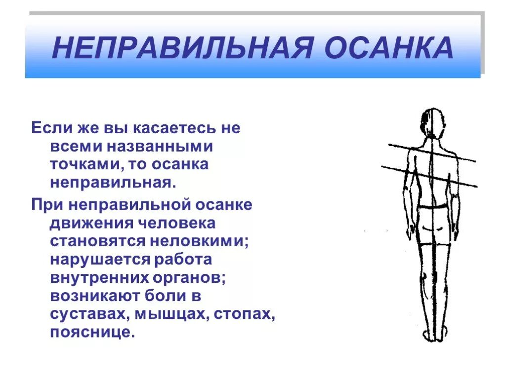 Важность осанки. Правильная осанка. Презентация на тему осанка человека. Реферат на тему осанка по физкультуре. Презентация на тему осанка.