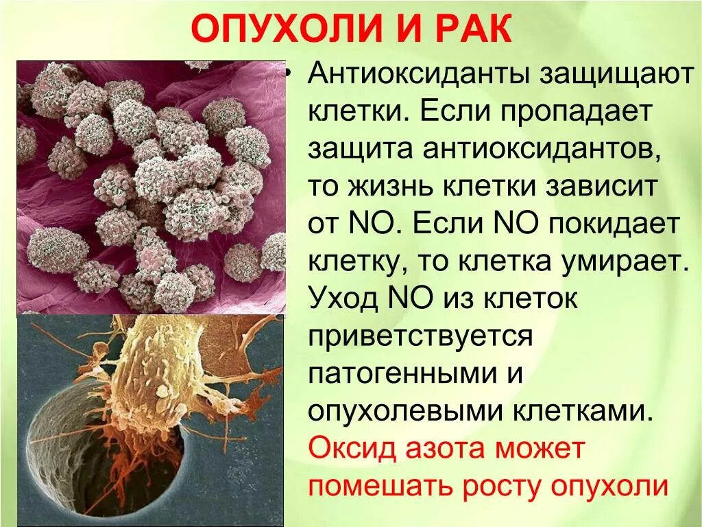 У скольких людей рак. Раковые клетки в организме человека. Опухоль раковые клетки. Образование раковых клеток в организме человека.