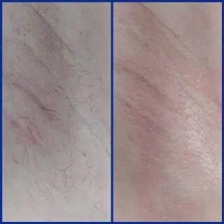 Шугаринг тольятти. Прайс шугаринг с картинкой шаблон. Сахарное моделирование прайс. Шугаринг сахар. Шугаринг тольятти.