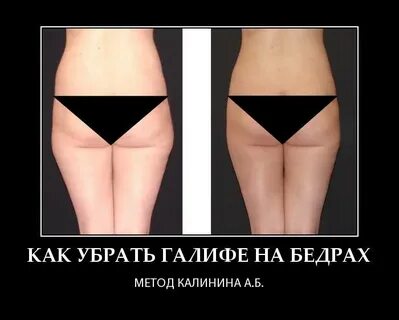 Ушки на бедрах